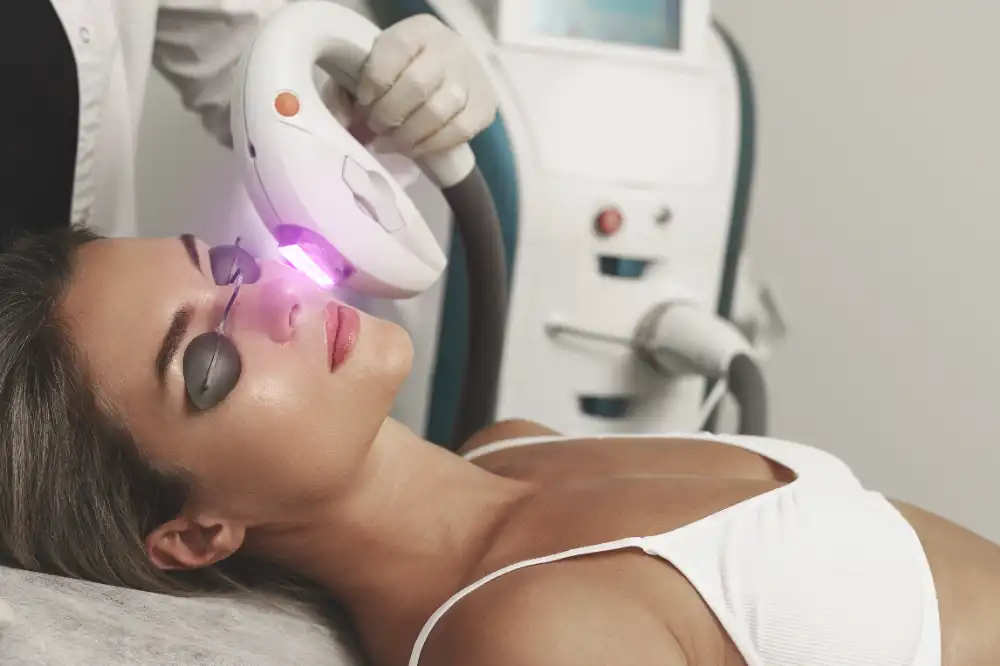 Transform Your Skin with IPL